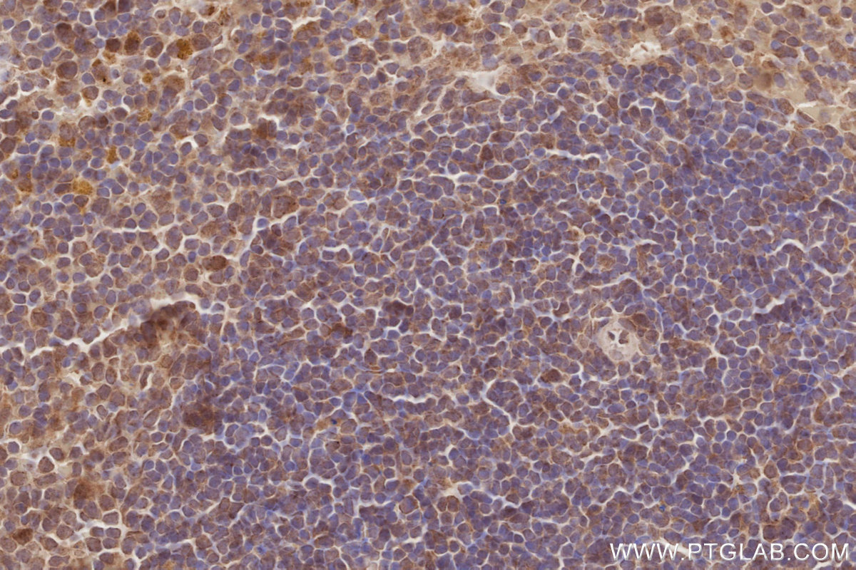 IHC staining of mouse spleen using 15491-1-AP