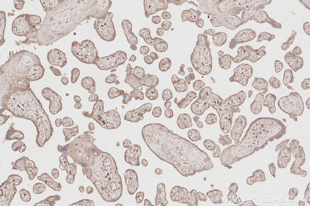 IHC staining of human placenta using 11318-1-AP