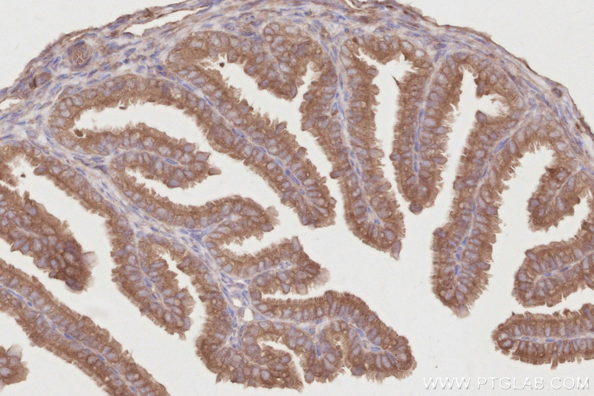 IHC staining of mouse ovary using 11318-1-AP