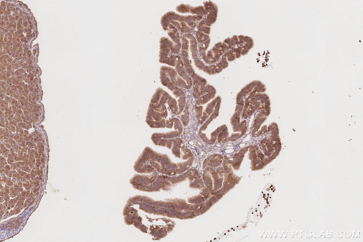 IHC staining of rat ovary using 11318-1-AP