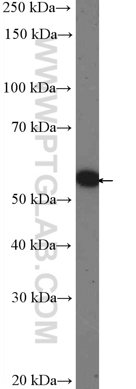 WB analysis of A549 using 14751-1-AP