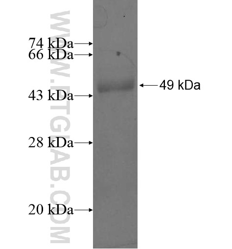 OSBPL2 fusion protein Ag11208 SDS-PAGE OSBPL2 fusion protein Ag11208 SDS-PAGE