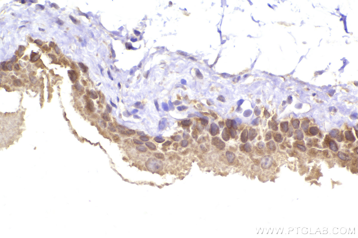 IHC staining of mouse bladder using 12417-1-AP IHC staining of mouse bladder using 12417-1-AP