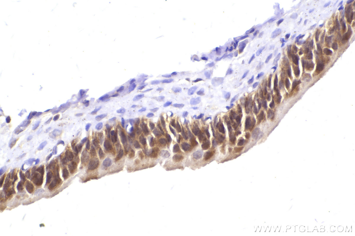 IHC staining of rat bladder using 12417-1-AP IHC staining of rat bladder using 12417-1-AP
