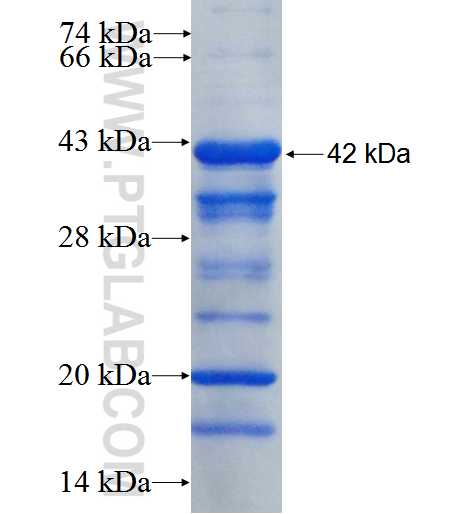 OSBPL3 fusion protein Ag26294 SDS-PAGE