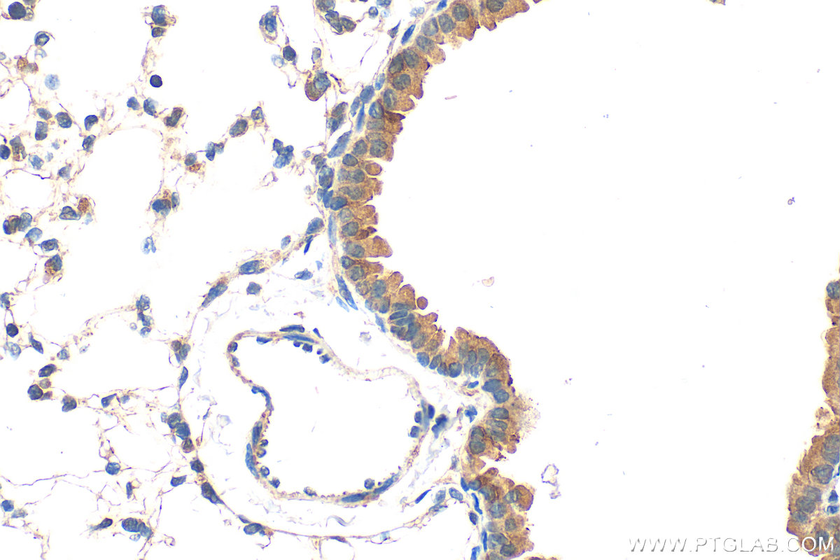 IHC staining of mouse lung using 32158-1-AP IHC staining of mouse lung using 32158-1-AP