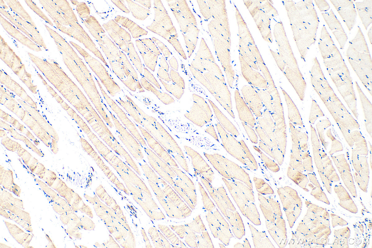 IHC staining of mouse skeletal muscle using 32158-1-AP IHC staining of mouse skeletal muscle using 32158-1-AP