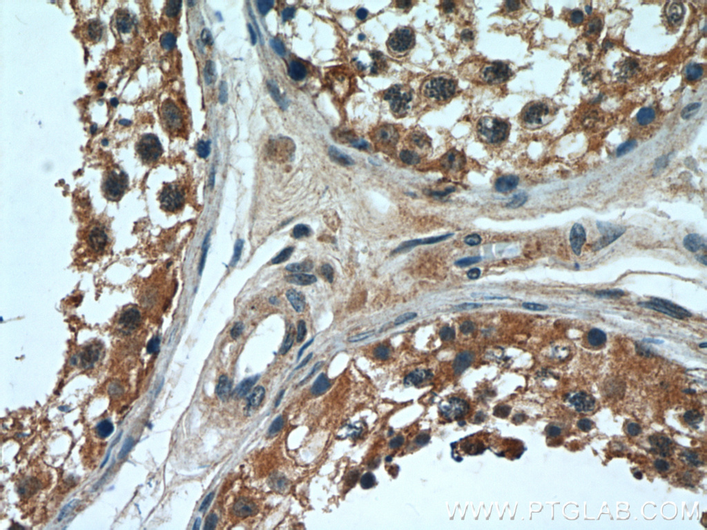 IHC staining of human testis using 11879-1-AP