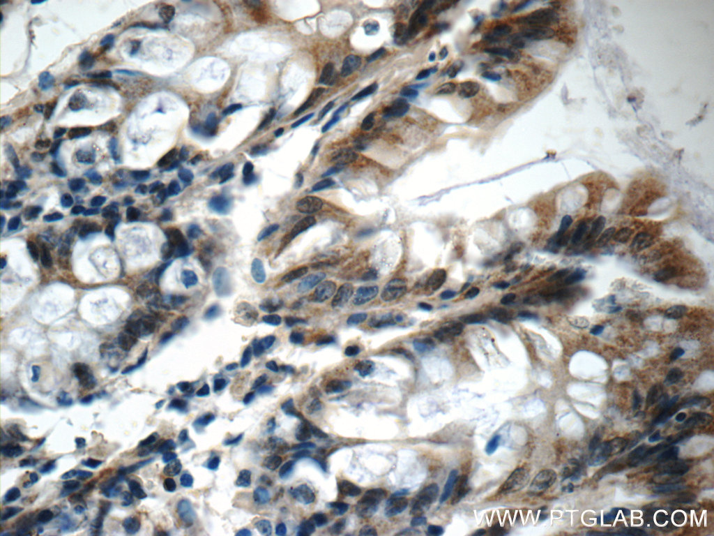 IHC staining of human colon using 25694-1-AP