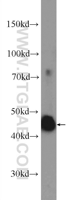 WB analysis of HeLa using 25694-1-AP
