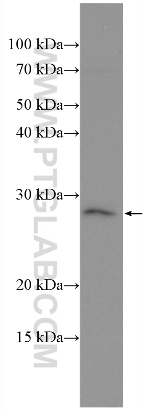 WB analysis of MCF-7 using 27792-1-AP