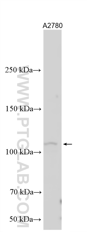 A2780 cells were subjected to SDS PAGE followed by western blot with 10982-1-AP (OSMR antibody) at dilution of 1:1000 incubated at room temperature for 1.5 hours. WB analysis using 10982-1-AP