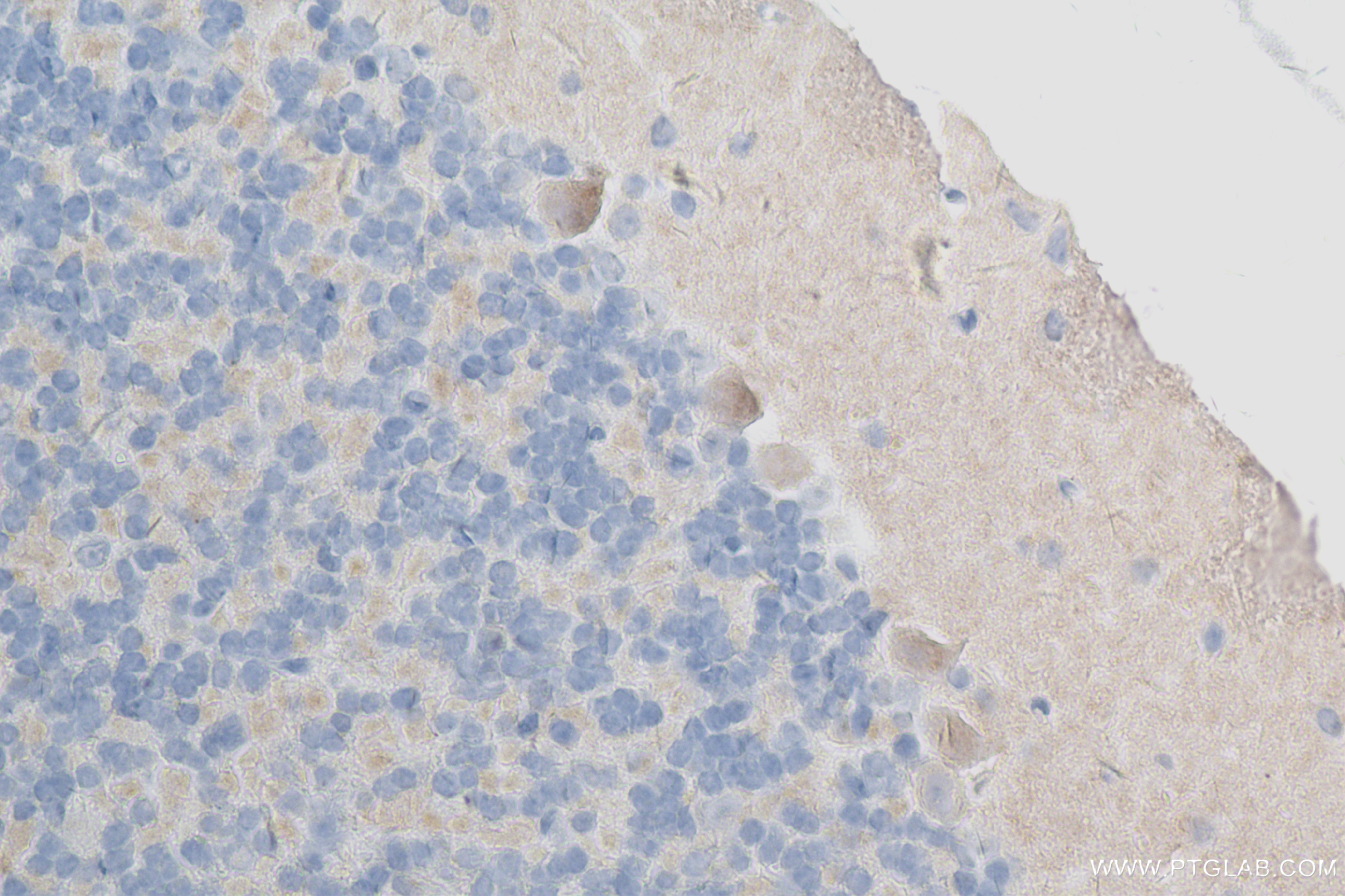 IHC staining of mouse cerebellum using 84555-2-RR