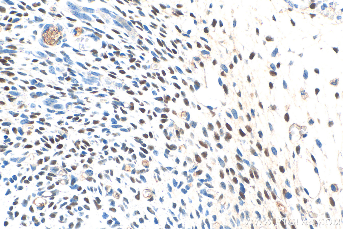 IHC staining of mouse embryo using 30606-1-AP