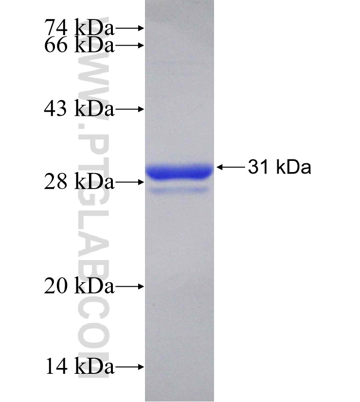 OSR1 fusion protein Ag31336 SDS-PAGE