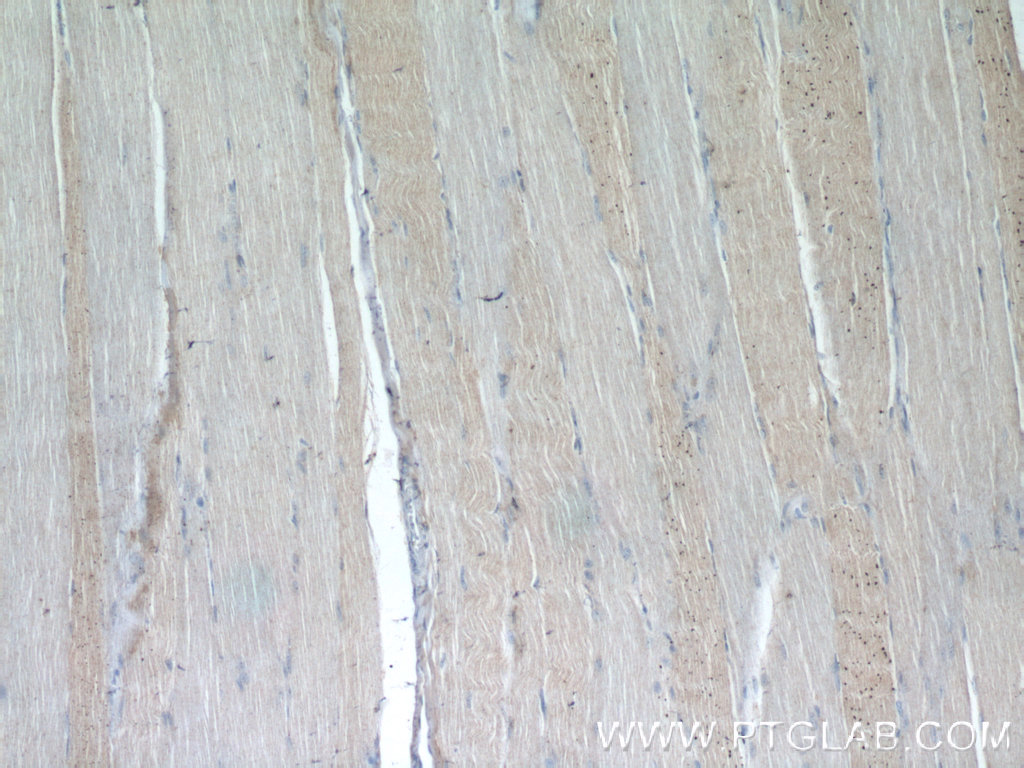 IHC staining of human skeletal muscle using 25207-1-AP