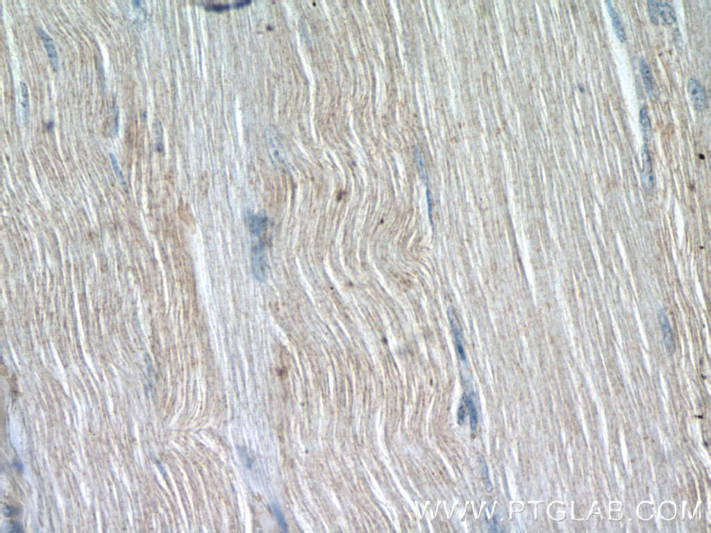 IHC staining of human skeletal muscle using 25207-1-AP