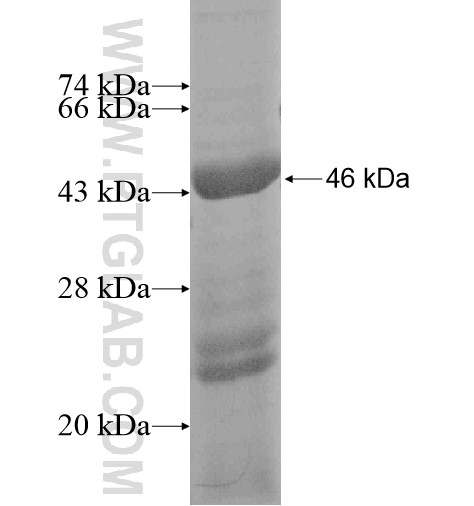 OTC fusion protein Ag13656 SDS-PAGE
