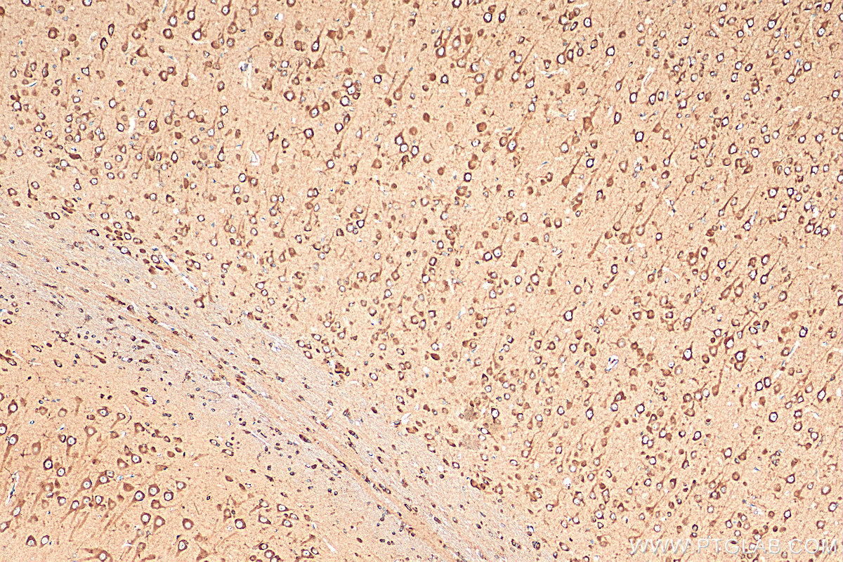 IHC staining of rat brain using 20721-1-AP
