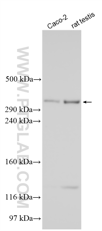 WB analysis using 33794-1-AP (same clone as 33794-1-PBS) WB analysis using 33794-1-AP (same clone as 33794-1-PBS)