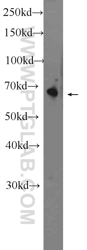 WB analysis of mouse heart using 24456-1-AP