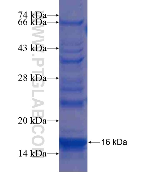 OTOP2 fusion protein Ag20218 SDS-PAGE OTOP2 fusion protein Ag20218 SDS-PAGE