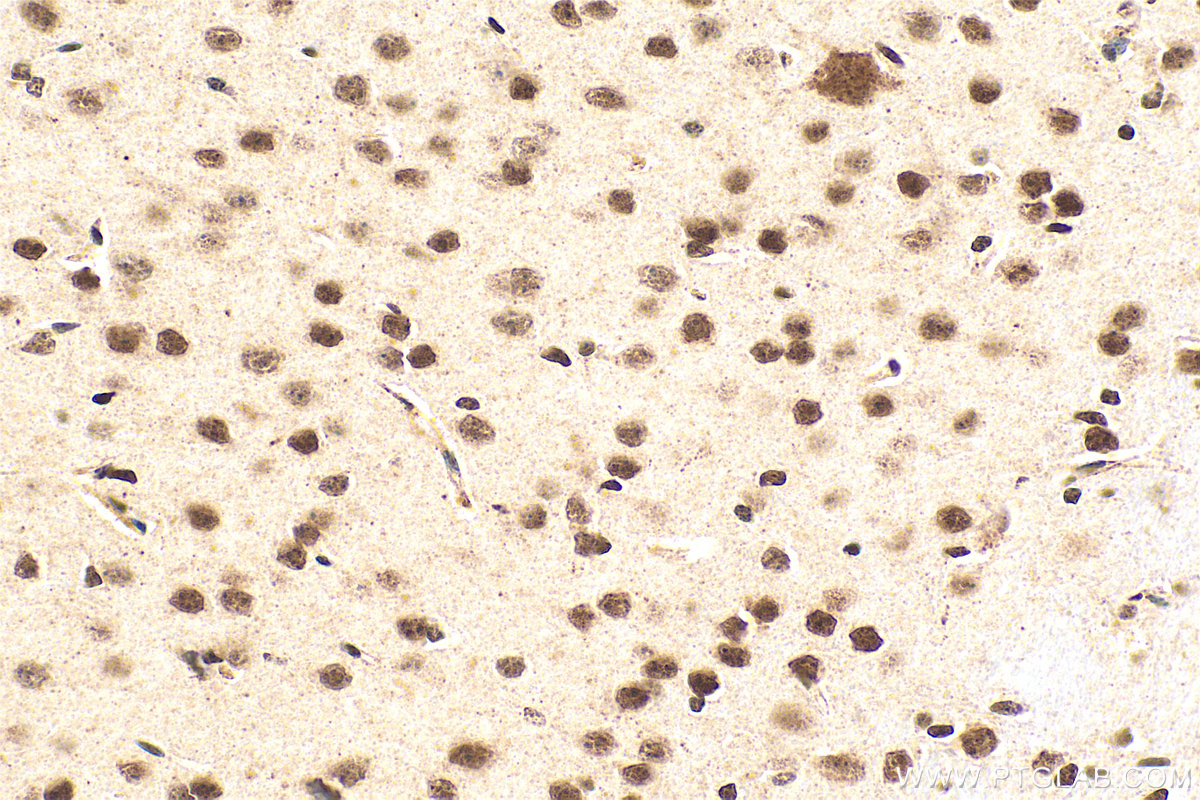 IHC staining of mouse brain using 14585-1-AP IHC staining of mouse brain using 14585-1-AP