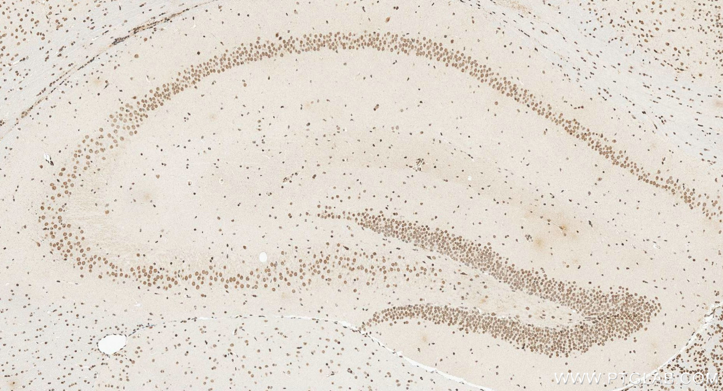 IHC staining of mouse brain using 14585-1-AP