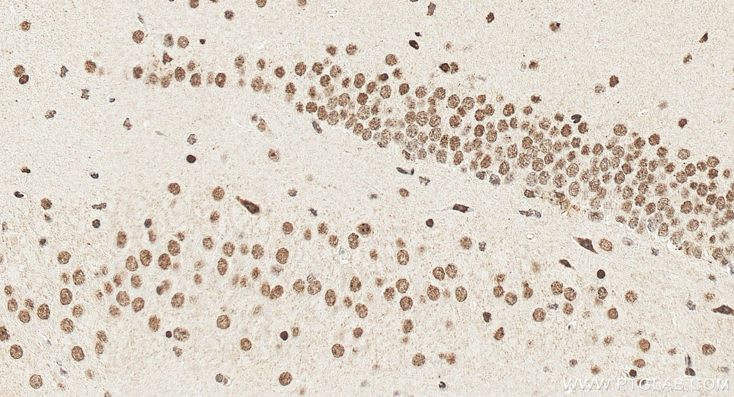 IHC staining of mouse brain using 14585-1-AP