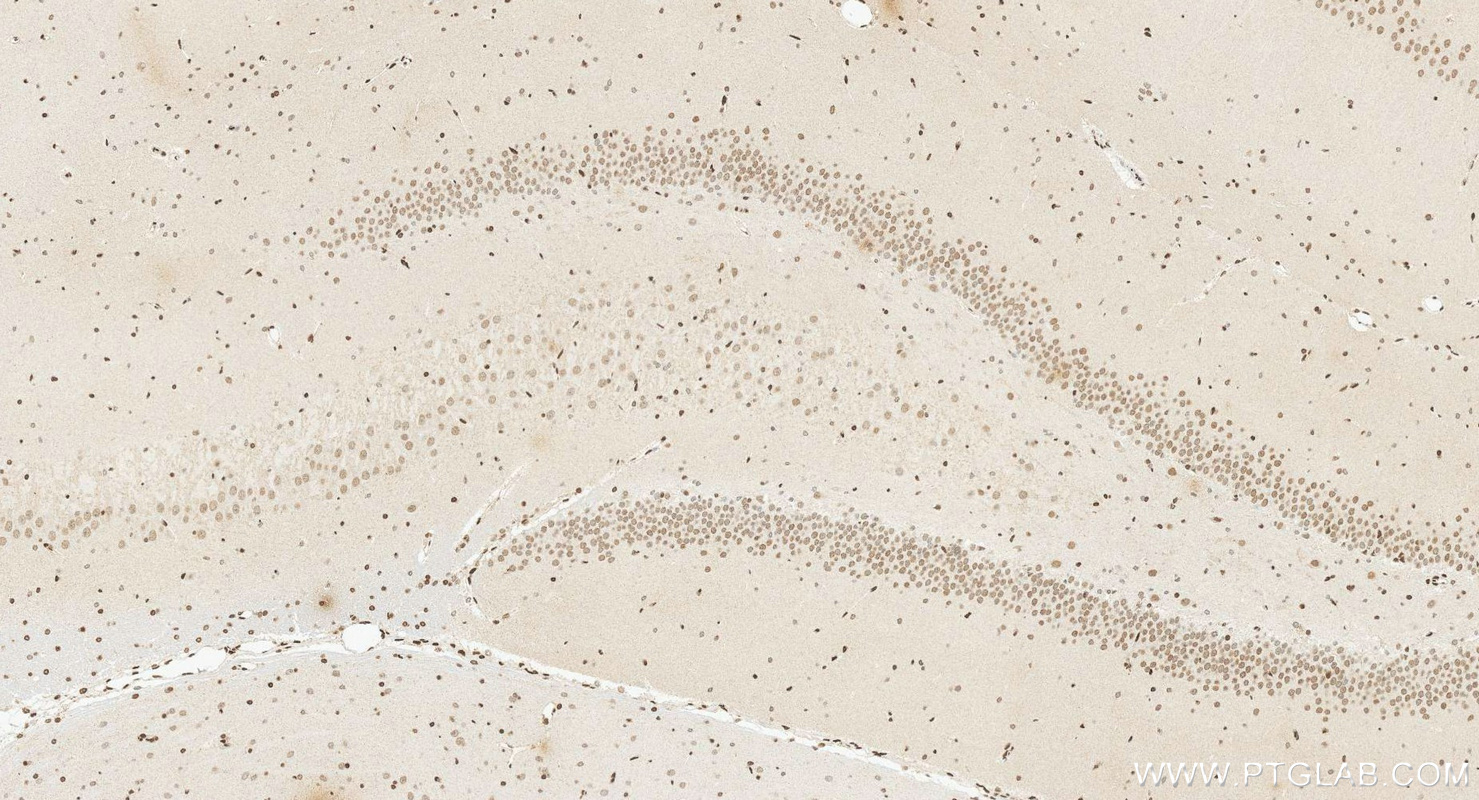 IHC staining of rat brain using 14585-1-AP