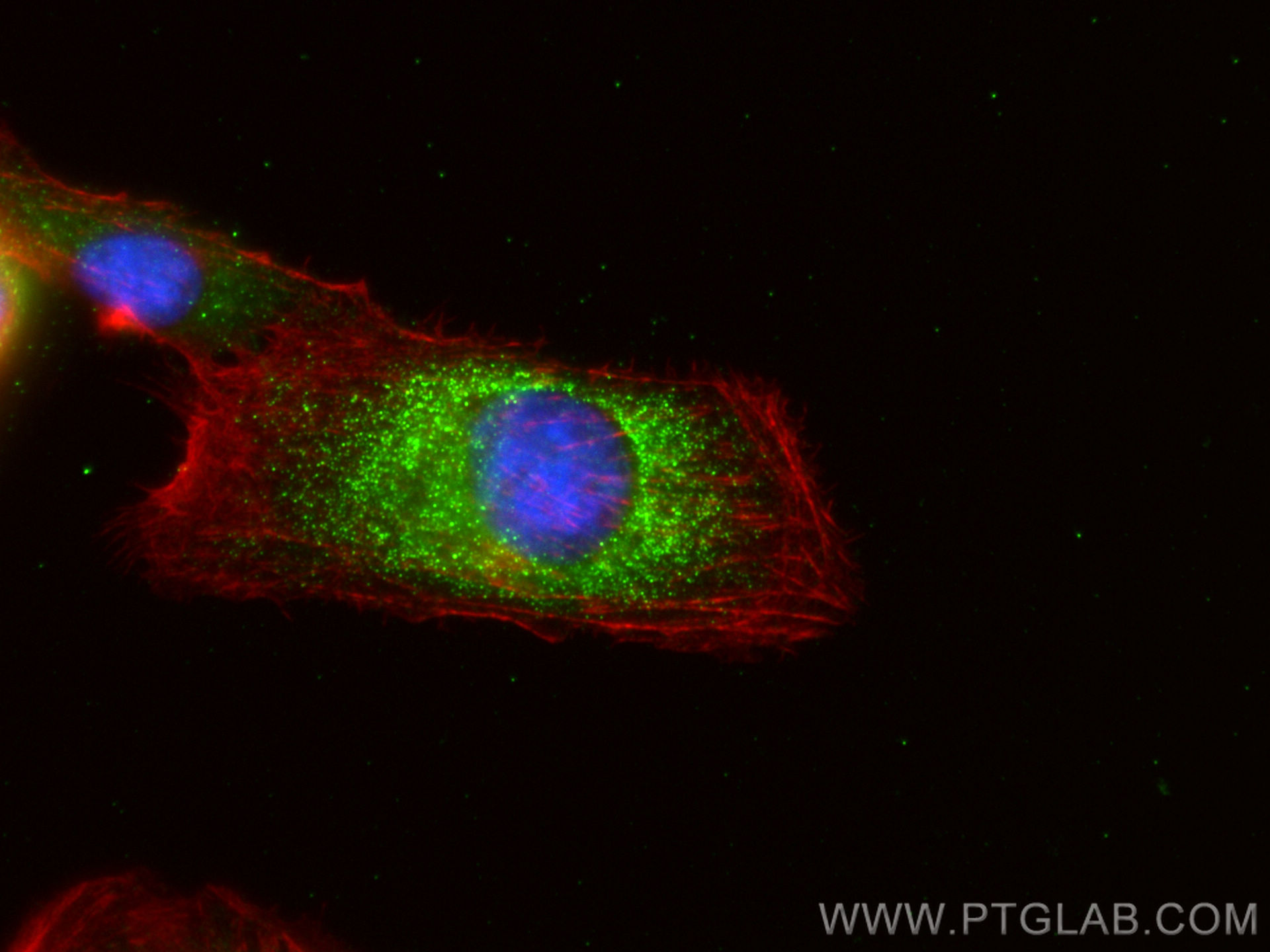 IF Staining of U2OS using 10573-1-AP