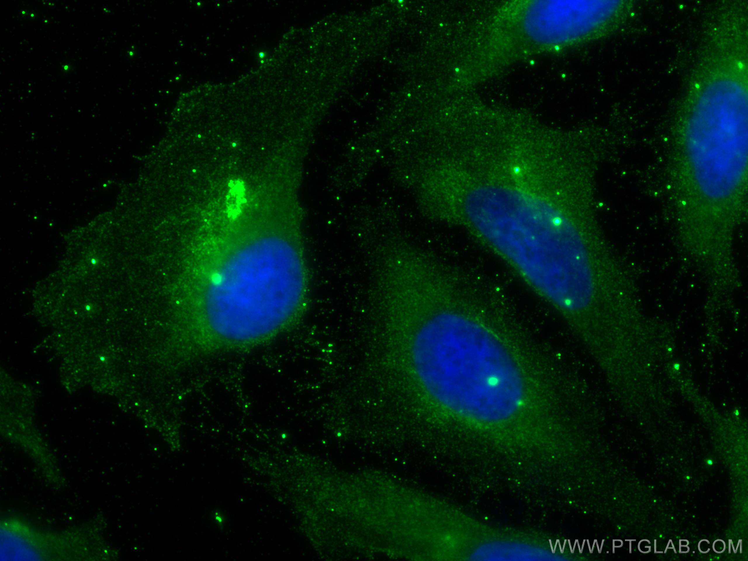 IF Staining of U2OS using 68489-1-Ig