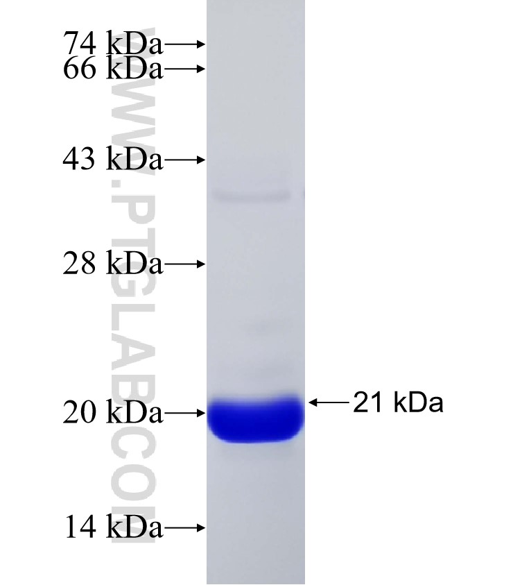 OTUD1 fusion protein Ag32010 SDS-PAGE OTUD1 fusion protein Ag32010 SDS-PAGE