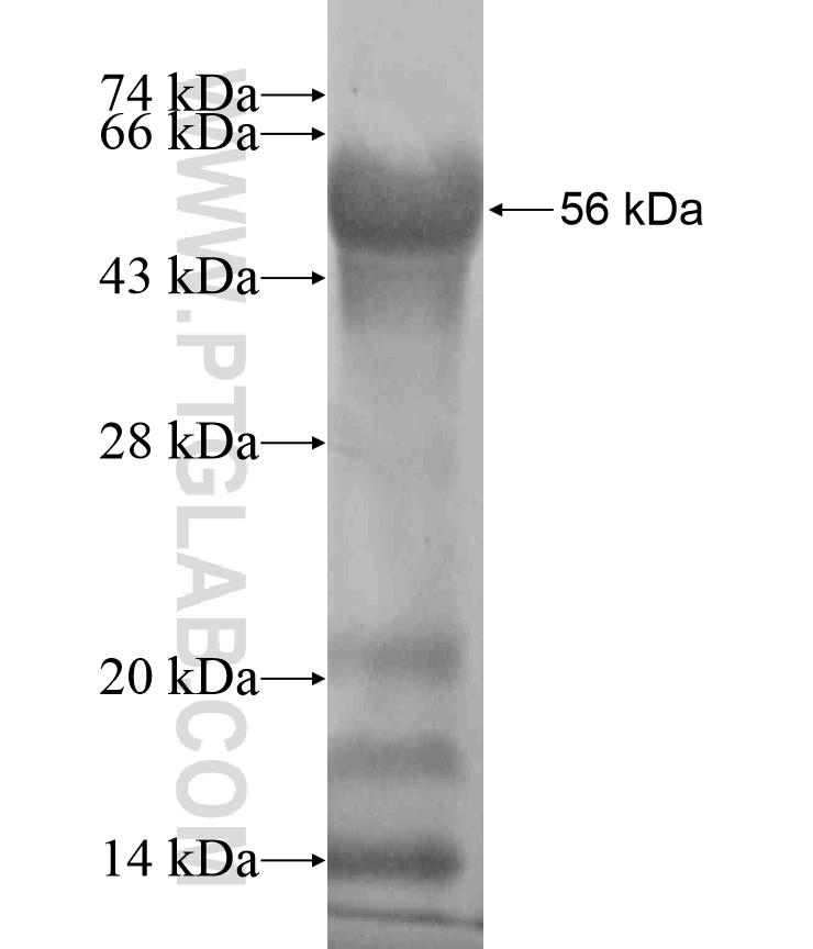 OTUD4 fusion protein Ag18145 SDS-PAGE OTUD4 fusion protein Ag18145 SDS-PAGE