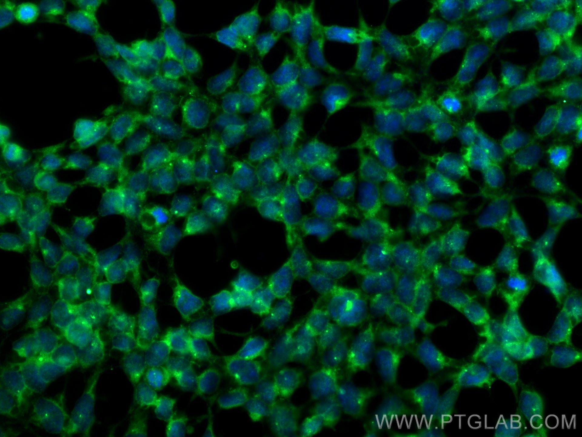 IF Staining of HEK-293 using 24486-1-AP