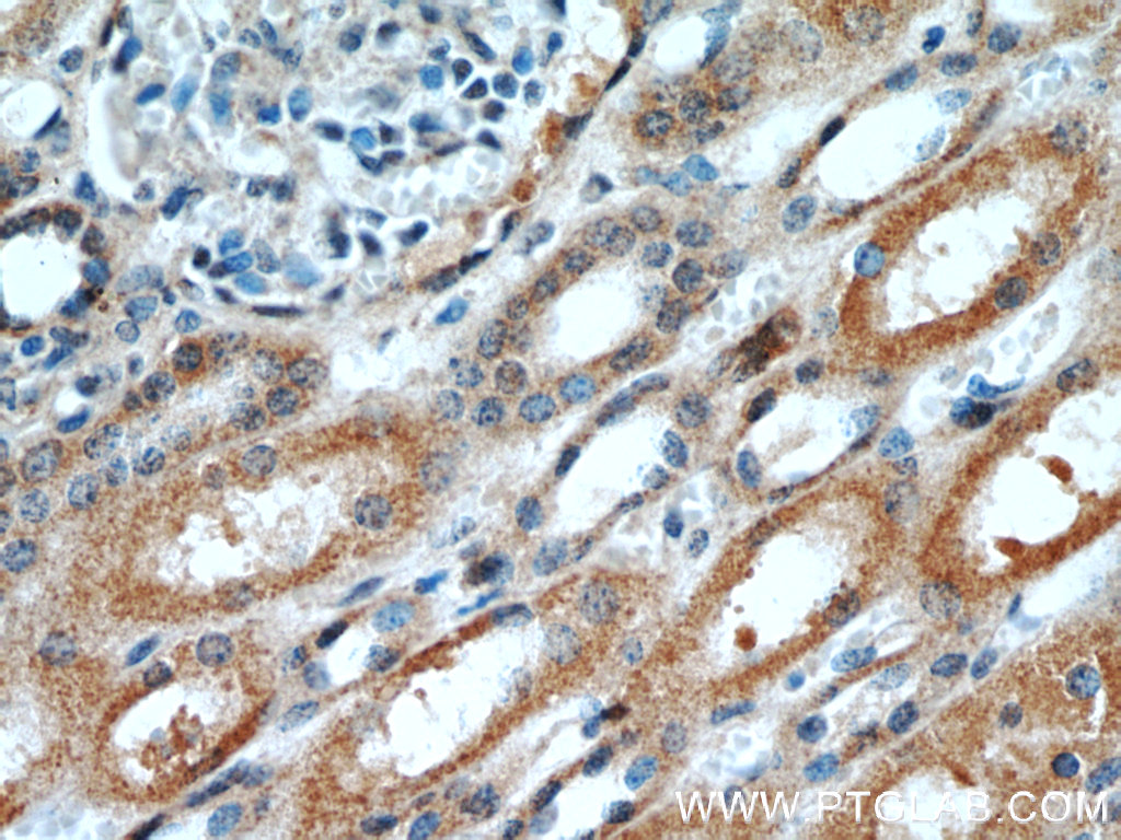 IHC staining of human kidney using 16605-1-AP