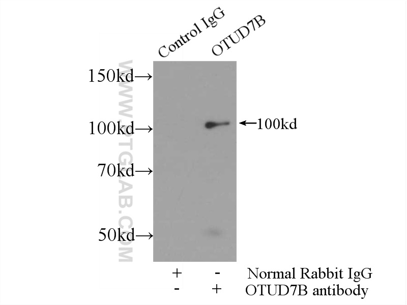 IP experiment of Jurkat using 16605-1-AP