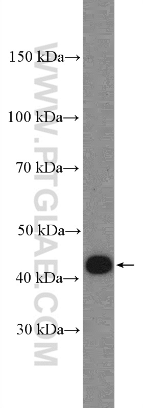 OTX1