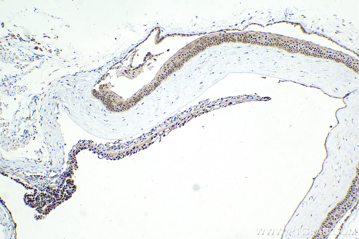 IHC staining of mouse eye using 13497-1-AP