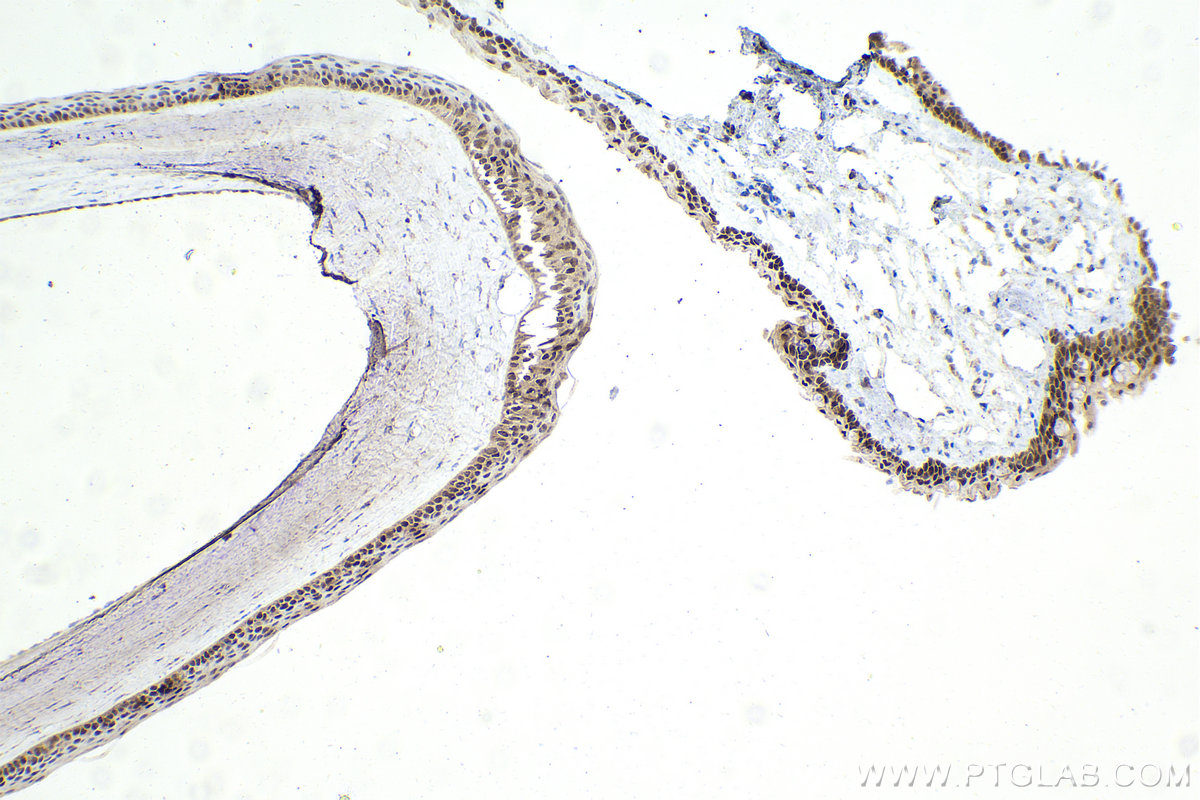 IHC staining of rat eye using 13497-1-AP