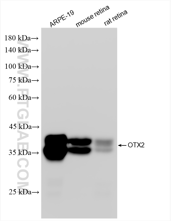WB analysis using 87372-1-RR WB analysis using 87372-1-RR