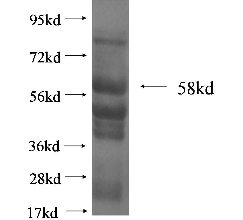 OTX2 fusion protein Ag4323 SDS-PAGE