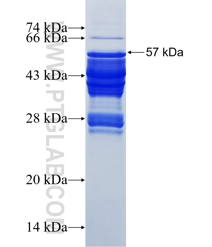 OTX2 fusion protein Ag4323 SDS-PAGE