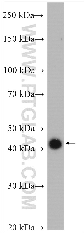 WB analysis of HeLa using 20112-1-AP