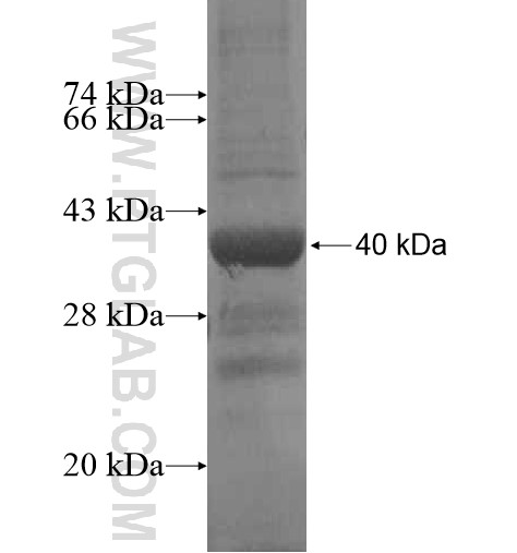 OVCA1 fusion protein Ag14041 SDS-PAGE