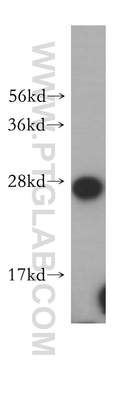 WB analysis of human kidney using 14943-1-AP