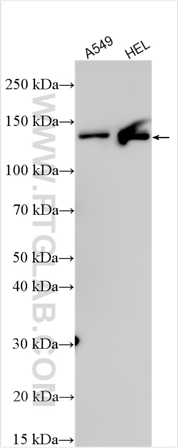 WB analysis using 32879-1-AP WB analysis using 32879-1-AP