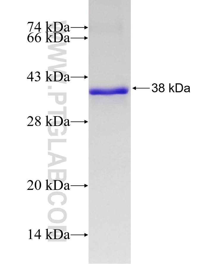 OVOL1 fusion protein Ag5198 SDS-PAGE