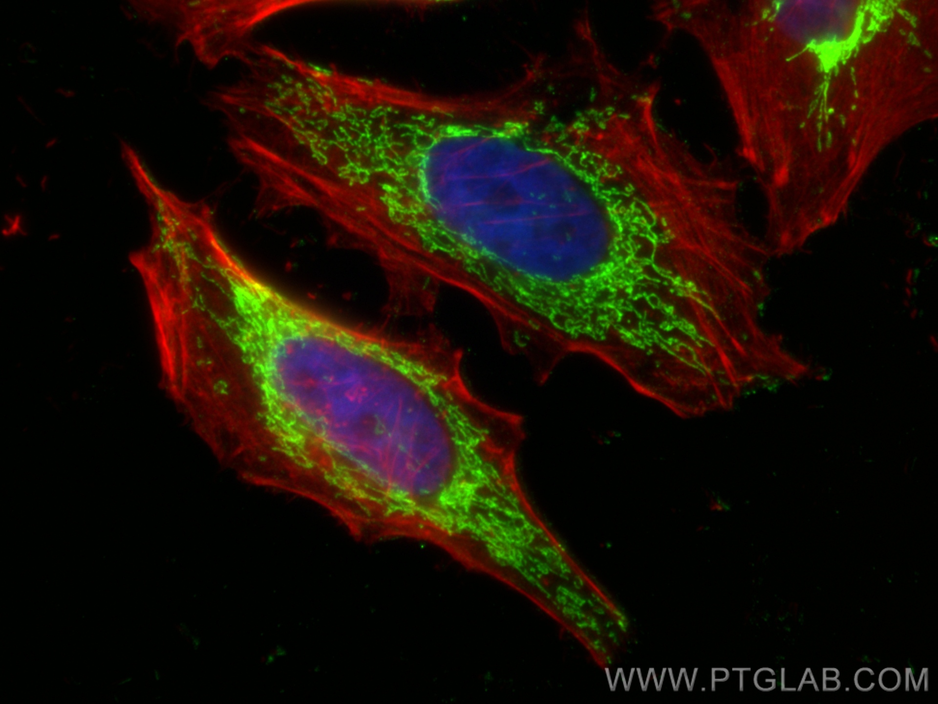 IF Staining of HeLa using 67836-1-Ig
