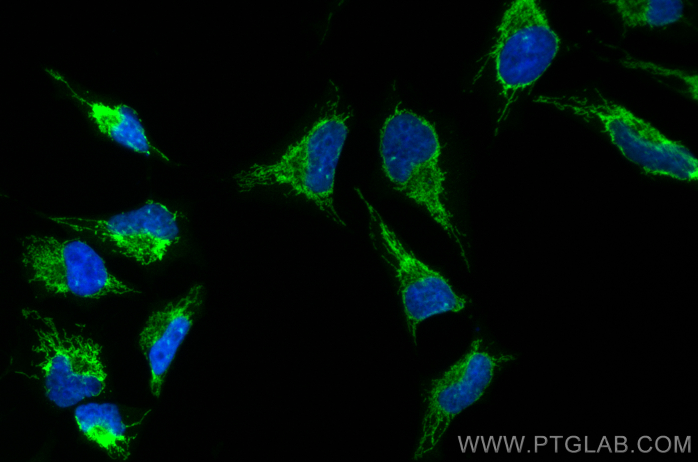 IF Staining of HeLa using CL488-12175